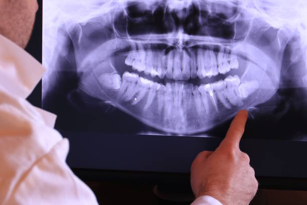 Best Broken or Chipped Tooth Repair in Gooding, ID