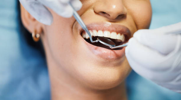 Best Emergency Cosmetic Dentistry (e.g., broken veneers) in Gooding, ID
